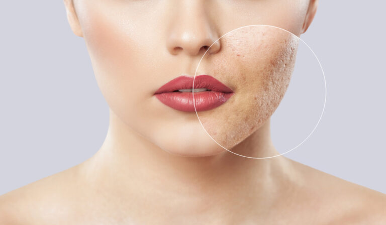 The Science Behind Skin Resurfacing: How It Works | Tondue Medical Spa